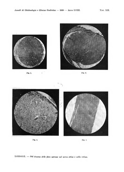 Annali di ottalmologia e clinica oculistica