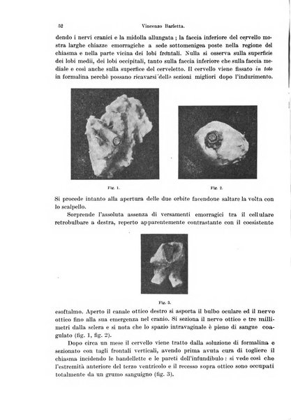 Annali di ottalmologia e clinica oculistica