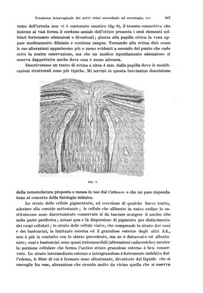 Annali di ottalmologia e clinica oculistica