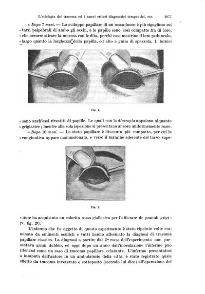 Annali di ottalmologia e clinica oculistica