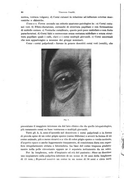 Annali di ottalmologia e clinica oculistica