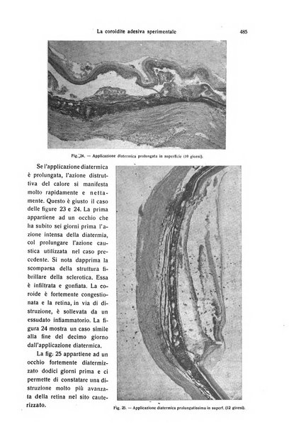 Annali di ottalmologia e clinica oculistica