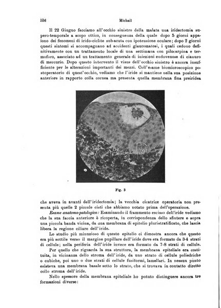 Annali di ottalmologia e clinica oculistica