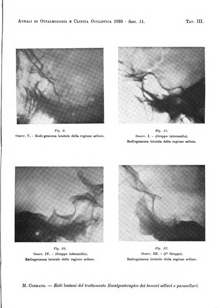 Annali di ottalmologia e clinica oculistica