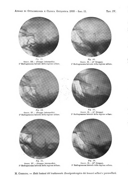 Annali di ottalmologia e clinica oculistica