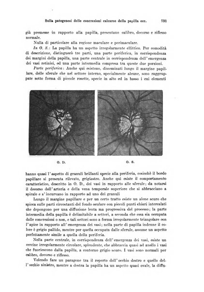 Annali di ottalmologia e clinica oculistica