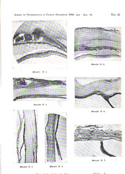 Annali di ottalmologia e clinica oculistica