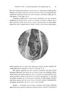 giornale/PUV0041464/1935/unico/00000101