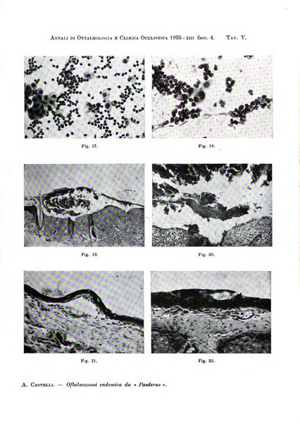 Annali di ottalmologia e clinica oculistica