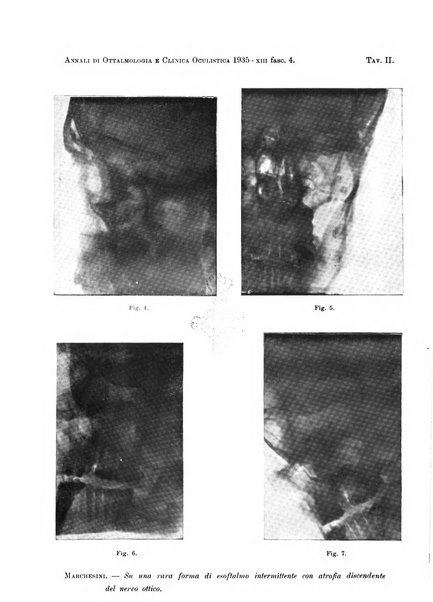 Annali di ottalmologia e clinica oculistica