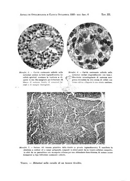 Annali di ottalmologia e clinica oculistica