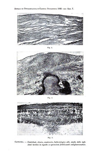 Annali di ottalmologia e clinica oculistica