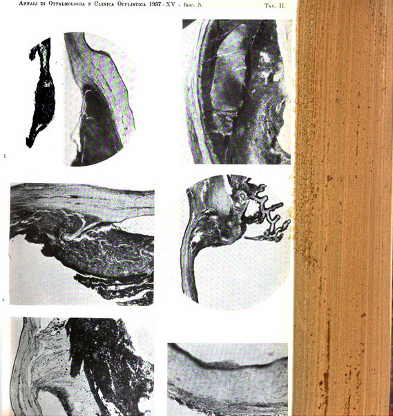 Annali di ottalmologia e clinica oculistica