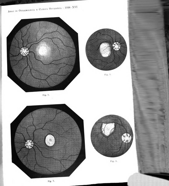 Annali di ottalmologia e clinica oculistica