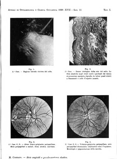 Annali di ottalmologia e clinica oculistica