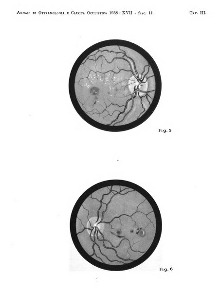 Annali di ottalmologia e clinica oculistica