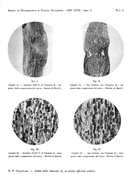 Annali di ottalmologia e clinica oculistica