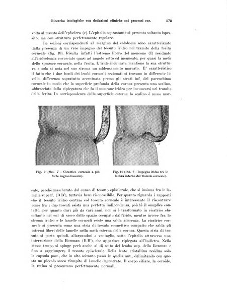 Annali di ottalmologia e clinica oculistica