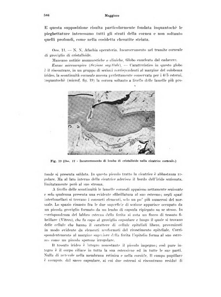 Annali di ottalmologia e clinica oculistica