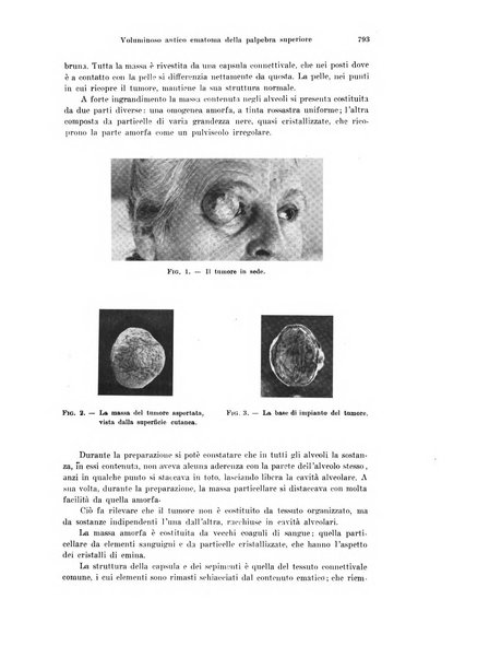 Annali di ottalmologia e clinica oculistica