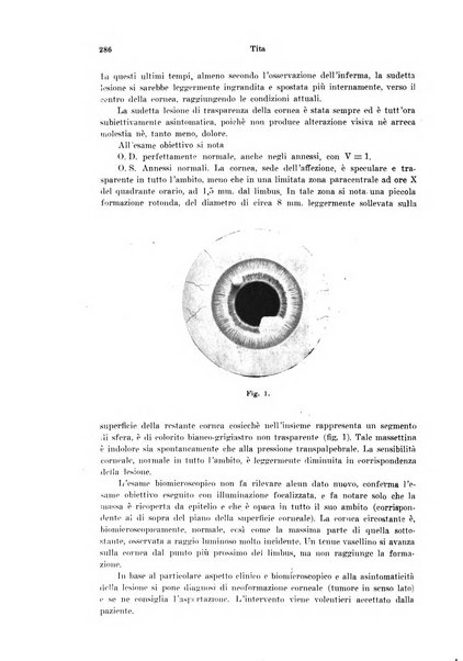 Annali di ottalmologia e clinica oculistica