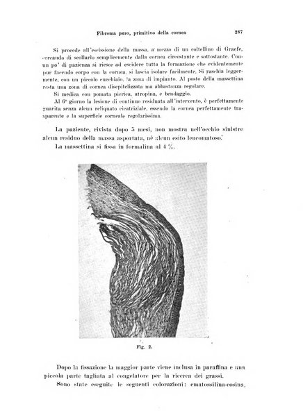 Annali di ottalmologia e clinica oculistica