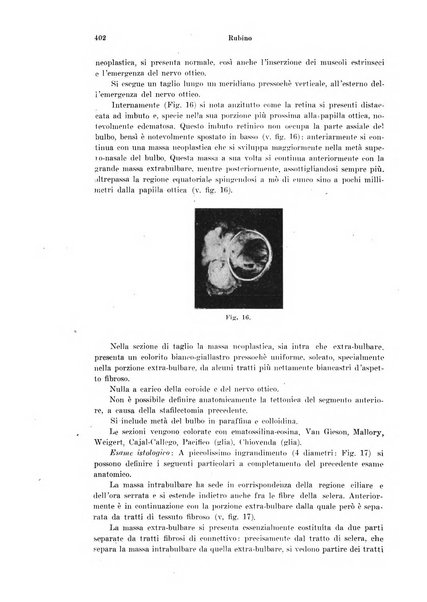 Annali di ottalmologia e clinica oculistica