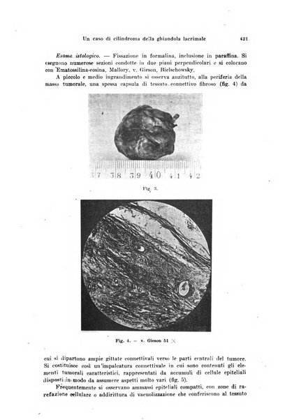 Annali di ottalmologia e clinica oculistica