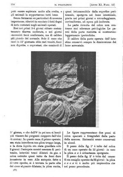 Il policlinico. Sezione pratica periodico di medicina, chirurgia e igiene