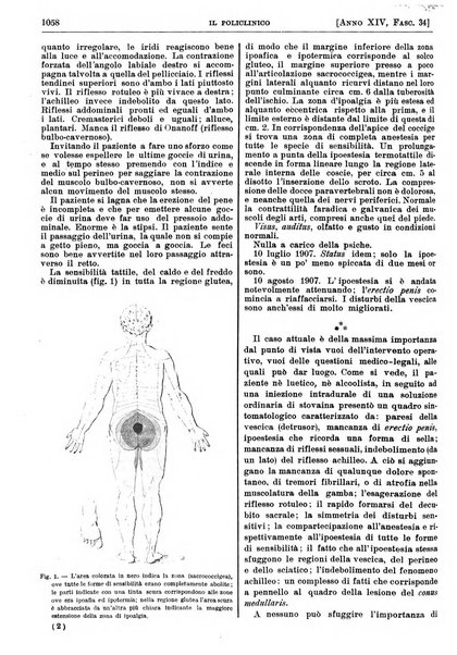 Il policlinico. Sezione pratica periodico di medicina, chirurgia e igiene