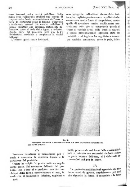 Il policlinico. Sezione pratica periodico di medicina, chirurgia e igiene