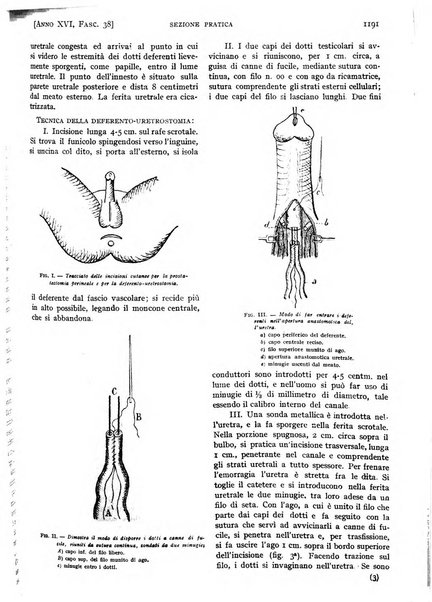 Il policlinico. Sezione pratica periodico di medicina, chirurgia e igiene