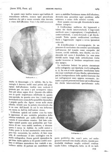 Il policlinico. Sezione pratica periodico di medicina, chirurgia e igiene