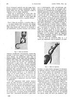 giornale/PUV0041812/1916/unico/00000946