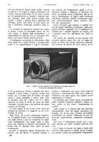 giornale/PUV0041812/1916/unico/00001074