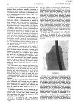 giornale/PUV0041812/1916/unico/00001174