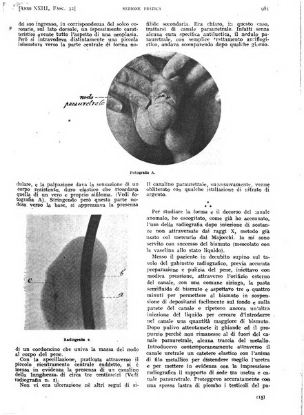 Il policlinico. Sezione pratica periodico di medicina, chirurgia e igiene