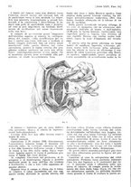 giornale/PUV0041812/1917/unico/00000542