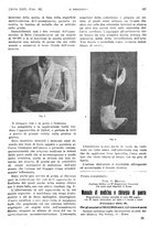 giornale/PUV0041812/1917/unico/00000613