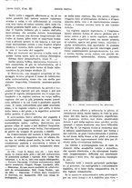 giornale/PUV0041812/1917/unico/00000867