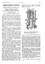 giornale/PUV0041812/1918/unico/00000501