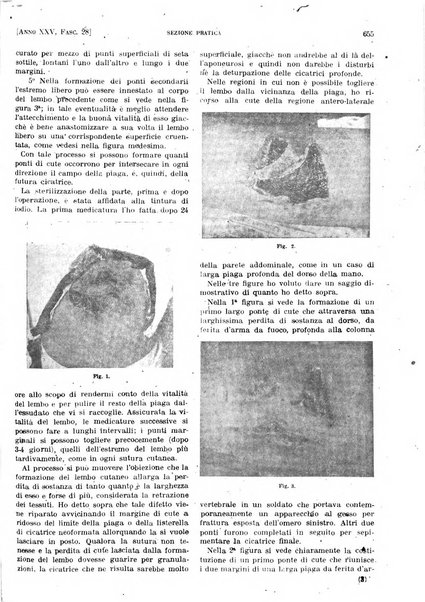 Il policlinico. Sezione pratica periodico di medicina, chirurgia e igiene