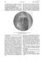 giornale/PUV0041812/1918/unico/00000862