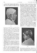 giornale/PUV0041812/1921/unico/00000600