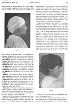 giornale/PUV0041812/1921/unico/00000601