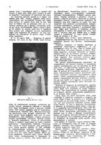 giornale/PUV0041812/1922/unico/00000048