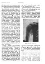 giornale/PUV0041812/1922/unico/00000049
