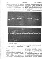 giornale/PUV0041812/1922/unico/00000870