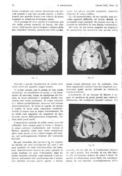 Il policlinico. Sezione pratica periodico di medicina, chirurgia e igiene