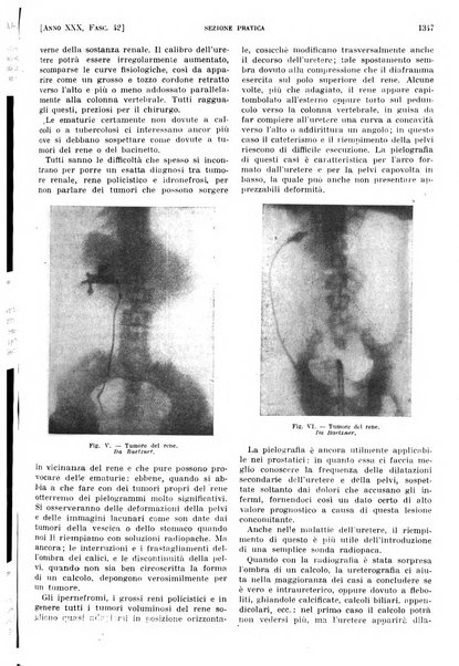 Il policlinico. Sezione pratica periodico di medicina, chirurgia e igiene